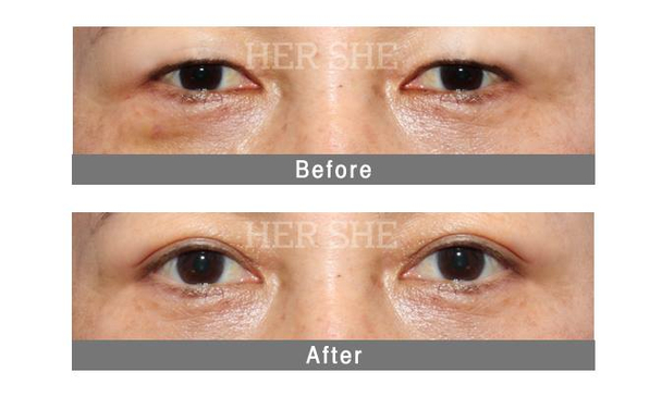 Slider image (4) HERSHE Plastic Surgery and Dermatology